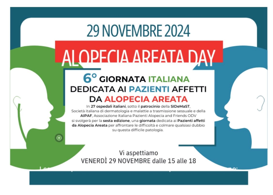 Policlinico Catania: alopecia areata day, venerdi’ 29 visite dermatologiche gratuite negli ambulatori del presidio Rodolico.